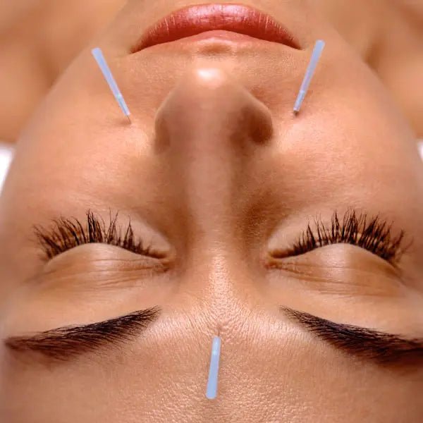 Akupunkturnadeln Typ B - braun - Seirin/3B